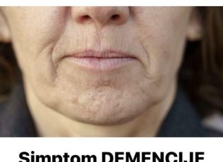 Simptom DEMENCIJE koji se javlja u ustima: Ako ga osjetite, obratite se ljekaru Simptom DEMENCIJE koji se javlja u ustima: Ako ga osjetite, obratite se ljekaru - featured image