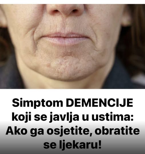 Simptom DEMENCIJE koji se javlja u ustima: Ako ga osjetite, obratite se ljekaru - featured image Simptom DEMENCIJE koji se javlja u ustima: Ako ga osjetite, obratite se ljekaru - featured image