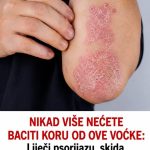 NIKAD VIŠE NEĆETE BACITI KORU OD OVE VOĆKE: Liječi psorijazu, skida bradavice i izbjeljuje zube NIKAD VIŠE NEĆETE BACITI KORU OD OVE VOĆKE: Liječi psorijazu, skida bradavice i izbjeljuje zube - featured image