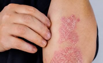 NIKAD VIŠE NEĆETE BACITI KORU OD OVE VOĆKE: Liječi psorijazu, skida bradavice i izbjeljuje zube NIKAD VIŠE NEĆETE BACITI KORU OD OVE VOĆKE: Liječi psorijazu, skida bradavice i izbjeljuje zube - featured image