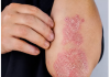 NIKAD VIŠE NEĆETE BACITI KORU OD OVE VOĆKE: Liječi psorijazu, skida bradavice i izbjeljuje zube