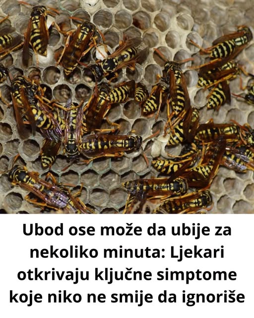 Ubod ose može da ubije za nekoliko minuta: Lekari otkrivaju ključne simptome koje niko ne sme da ignoriše - featured image Ubod ose može da ubije za nekoliko minuta: Lekari otkrivaju ključne simptome koje niko ne sme da ignoriše - featured image