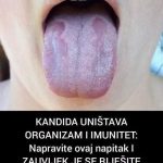KANDIDA UNIŠTAVA ORGANIZAM I IMUNITET: Napravite ovaj napitak I ZAUVIJEK JE SE RIJEŠITE (RECEPT) KANDIDA UNIŠTAVA ORGANIZAM I IMUNITET: Napravite ovaj napitak I ZAUVIJEK JE SE RIJEŠITE (RECEPT) - featured image