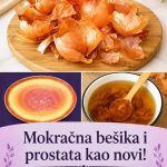 Mokraćna bešika i prostata kao novi: Djedov stari lijek od ljuske luka Mokraćna bešika i prostata kao novi: Djedov stari lijek od ljuske luka - featured image