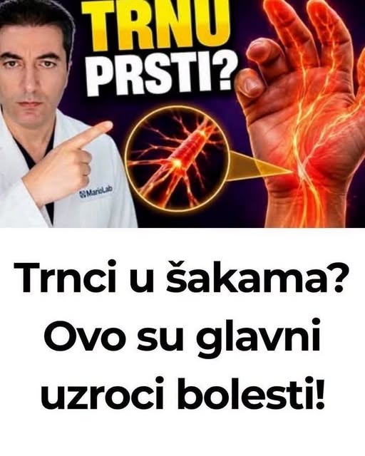Trnci u šakama? Ovo su glavni uzroci bolesti! - featured image