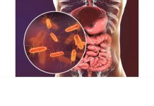Pojedite ovu voćku svaki dan i creva će raditi kao sat: Tvrdi doktorka Pojedite ovu voćku svaki dan i creva će raditi kao sat: Tvrdi doktorka - featured image