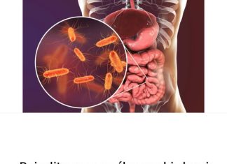 Pojedite ovu voćku svaki dan i creva će raditi kao sat: Tvrdi doktorka Pojedite ovu voćku svaki dan i creva će raditi kao sat: Tvrdi doktorka - featured image