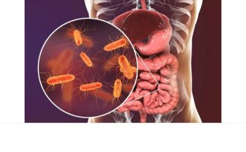Pojedite ovu voćku svaki dan i creva će raditi kao sat: Tvrdi doktorka Pojedite ovu voćku svaki dan i creva će raditi kao sat: Tvrdi doktorka - featured image